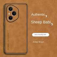 Plain leather comfortable suede case For Honor 400 Pro Honor400 400 Lite 300 200 100 90 70 Honor X9b