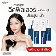 [E-voucher] ฟิลเลอร์สวีเดน Filler ปรับรูปหน้า (สวีเดน) เติมตรงไหน หน้าก็ปัง จากแฮวอน คลินิก Haewon C