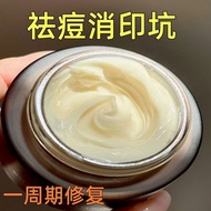 Repair Acne Marks Acne Marks Non-Single Essential Oil Repair Acne Marks Acne Marks Acne Marks Acne M