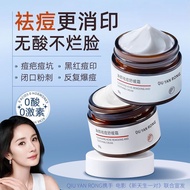 Gentle Acne Removal Paste Removal Acne Removal Paste Medical#温和祛痘祛痘膏去痘印医用学生祛痘膏祛痘印淡化痘印青春痘修复闭口粉刺04012x