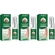 Ouhoe serum toenail essence manicure pedicure soft fungus in yellow thick ingrown repair nail care (