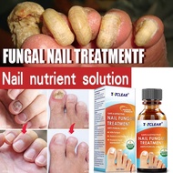 Treatment Fungal Nail Essence Serum Care Repair Foot Nail Fungus Removal Gel Anti Infection Paronychia Onychomycosis Product