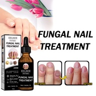 EELHOE Nail  Fungus Treatment Oil 30ml Nail Repair Fungal Treatment- Nail Care Liquid Repair Moistur