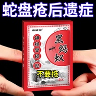 Post-Remaining Neuropathy with Herpes Post-Remaining Neuropathy Skin Pain Tearing Fire Pain External