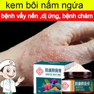 Itchy fungus cream, itching relief cream, anti-itch cream, 30g eczema skin Itchy skin fungus blister