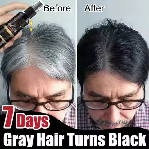 Gray White Hair Treatment Serum Cover White Hair To Black Natural Color Repair Spray Anti Loss Hair 