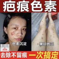 Remove Skin Melanin Precipitation Black Marks Mosquito Marks Hot Scars Face Remove Reduce Scars On L