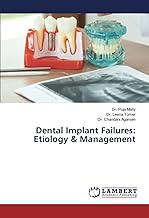 Dental Implant Failures: Etiology & Management
