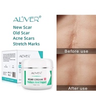 Original ALIVER Scar Repair Cream (for old leg scars) Stretch Mark Remover Acne Scar Remover 50g