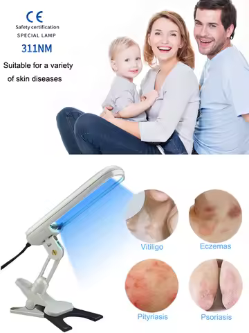 311NM UVB Phototherapy Lamp Device for Vitiligo Treatment UV NarrowBand Ultraviolet Light Therapy Ps