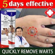 OUHOE  Wart Removal Cream Krim Penghilang Lalat, Krim Penghilang Kutil, Mudah Dibawa Untuk Semua Kul