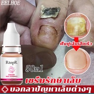 M-S เซรั่มบำรุงเล็บ ยาทาเล็บป้องกันเชื้อแบคทีเรีย [10ml] รักษาโรคเชื้อราที่เล็บ เล็บพัง ดูแลเล็บ เซร