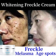 Krim jeragat krim melasma whitening freckle cream dark spot remover Light spots break down melain blemish whitening 祛斑霜