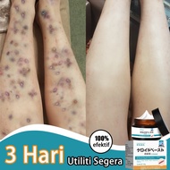 Scar Removal Cream Ubat Parut Hilangkan Parut Hitam Hilangkan Parut Kaki Menghilangkan Bekas Luka Me