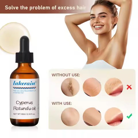 Inhibit Hair Growth 60ml Cyperus Rotundus Oil Nourish the Skin Ingredients are Safe Wide Scope of Ap