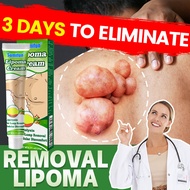 Lipoma removal cream Lipoma cream Lipoma ointment 20g Fat granule care Lipoma cream benjolan ubat be