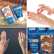 Kem giảm nhăn giảm nổi gân tay  Kpem  chống lão hóa da tay Kem dưỡng da tay chính hãng nga 100ml