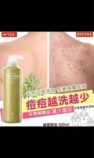 【韓國製造 痘印拜拜艾草淨痘沐浴乳 500ml】 #現貨