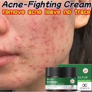 LYDIMOON Acne Cream 30g Fades Acne Scars Acne Treatment Cream & Scar-Reducing Formula Acne Cream Fac