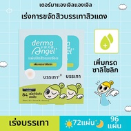 Derma angel | แผ่นปิดสิวซ่อนจุดบกพร่อง 84 ชิ้น