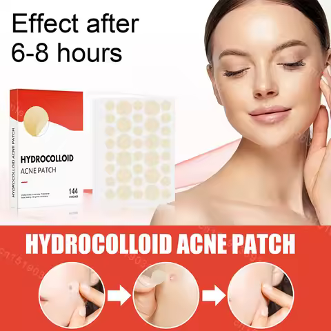 144/288Pcs Face Skin Care Acne Pimple Patch 2 Sizes Invisible Professional Healing Absorbing Spot St