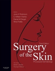 Surgery of the Skin E-Book C. William Hanke, MD, MPH, FACP