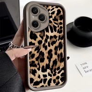 Phone Case: Advanced Tiger Skin Leopard Print Phone Case 200 400 90 Lite Magic 7 Lite X6a X7a X7b X7