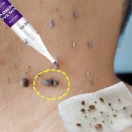 COD Warts remover original Mole remover Skin tag remover Removal melanin spots