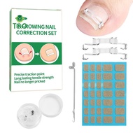 T&O 1/2 Set Ingrown Toenail Corrector Tools Pedicure Recover Embed Toenail Treatment Professional Fo