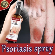 [NEW]Ubat Gatal Kulit Kulit Herba Cina Eczema Cream Ubat Kurap Anti Itch Topical Itchy Antifungal Ps