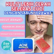 Sabun Pencuci Muka Untuk Lelaki dan Wanita , Sabun Jerawat , Anti Acne , Sabun Jeragat ,| Sabun Bada