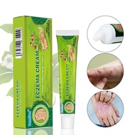 Eczema Cream Krim Psoriasis Cream Gatal Ketuat Krim Eczema Treatment Antifungal Cream Itchy krim ekz