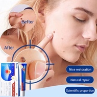 Medical Clearing Ning Large Dosage Antipyretic Gel Miyamoto Wuxiao Premium Gel