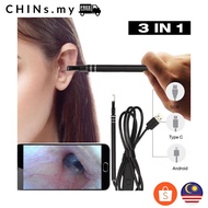 Digital Led Otoscope Ear Camera Scope Earwax Removal Kit Ear Wax Cleaning Tool Endoscopic