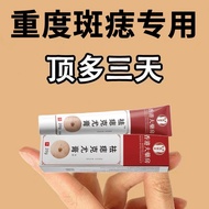 Do Not Leave Marks Remove Moles Cream for Whole Body Use 9.9