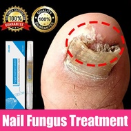 EELHOE Ubat Kuku Ubat Kulat Kuku Nail Fungus Treatment Nail Repair Stop Fungal Growth Anti Onychomyc