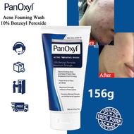 Panoxyl Acne Foaming Wash 10% Benzoyl Peroxide