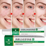 20g Aloe Vera Acne Removal Cream Oil Control Acne Cream Skin Care Whitening Moisturizing Herbal Gel Facial Skin Care