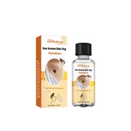 SOUTH MOON Bee Venom Skin Tag Solution Skin Tag Remover Tag Solution Buang Kutil Corn Plaster Warts