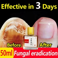 3-day effective  Nail Fungus Repair Nail Repair Solution 50ml Quick repair of damaged nails Effectiv