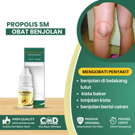 Obat Benjolan Di Belakang Lutut Obat Penghilang Benjolan Di Lutut Obat Kista Baker Lutut Kiri Kanan