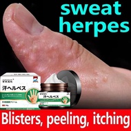 Antibacterial Cream Eczema Anti Itching Sweat Herpes Treatment Ointment Dermatitis Psoriasis Cream R