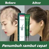 Obat penumbuh rambut Penumbuh rambut botak Serum penumbuh rambut Hair