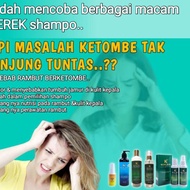 Anti-dandruff shampoo Men Hair Loss shampoo KOCHA Dandruff shampoo And Hair Loss & hairtonic