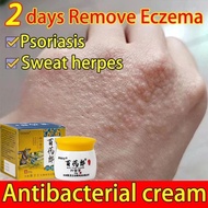 Eczema cream krim gatal kulit herba Cream gatal kulit Gatal Kulit Herba Cina Antifungus Anti-Itching