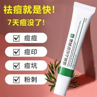 skin care Acne Cream Acne Scar Removal Acne Scar Repair Acne Scar Removal Acne Scar Remover Magic Ac
