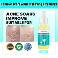 DermaLab Emu Renew Serum (30ml) – Targeted Pitted Scar Repair, Deep Hydration & Anti-Inf