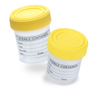 URINE CONTAINER (YELLOW CAP)