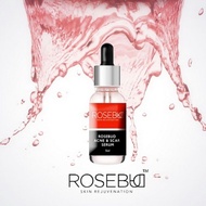 ROSEBUD ACNE & SCAR SERUM 5ML