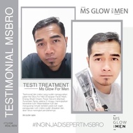 facial wash ms glow man (ecer)